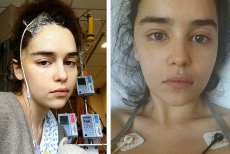 Фотография: 6 знаменитостей, которые перенесли тяжелые операции и оказались на грани смерти №1 - BigPicture.ru