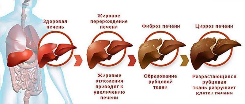 Самодиагностика системы Печени и Желчного пузыря Самодиагностика системы Печени и Желчного пузыря