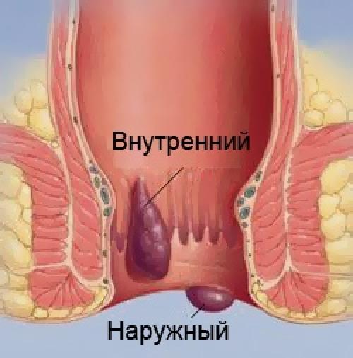 Секреты яншэн. Упражнение Возвращение Весны. 04