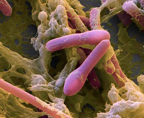 Возбудитель ботулизма Clostridium botulinum