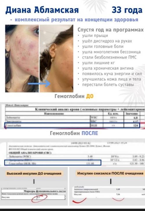 Мои коллеги и их результаты на очищение! 03 Мои коллеги и их результаты на очищение! 03