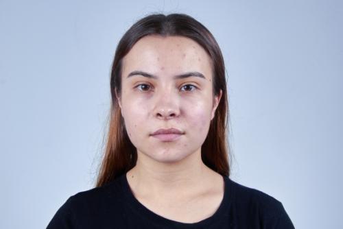 Скрыть недостатки: советы косметолога по уходу за проблемной кожей 01 Скрыть недостатки: советы косметолога по уходу за проблемной кожей 01