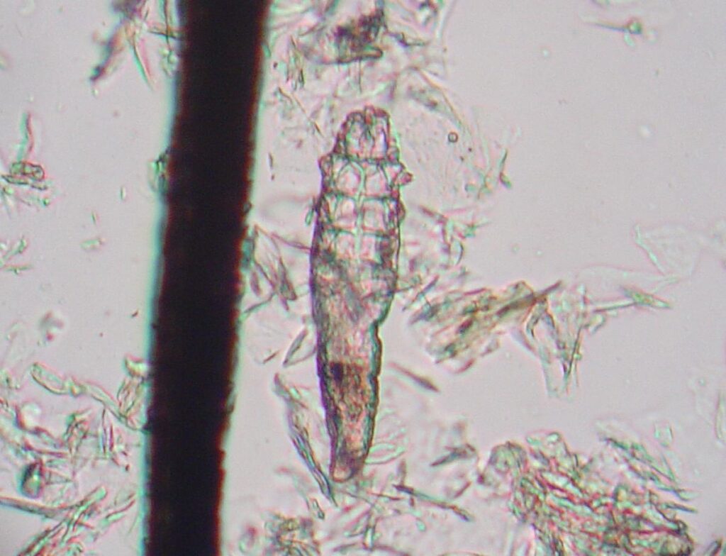 Клещи: что нужно знать, и чем они опасны 6 demodex mite 1